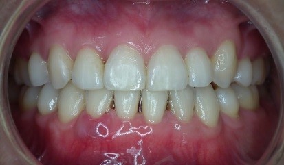 Praktijk voor Orthodontie in Hoofddorp Tandartspraktijk Overbos